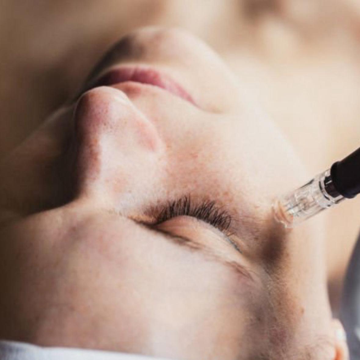 Microneedling Online Course - Elizabeth Sands Beauty School