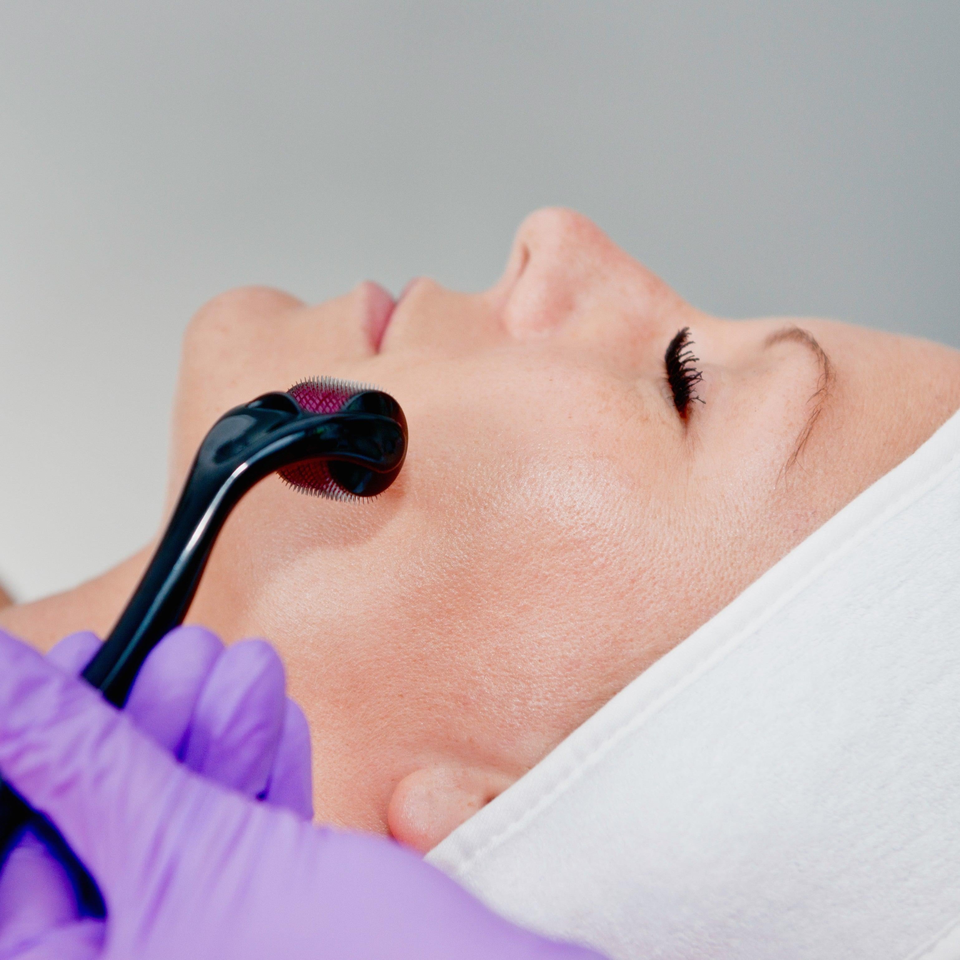 Microneedling Glow & LED Facial Training Course - ElizabethSands Beauty School